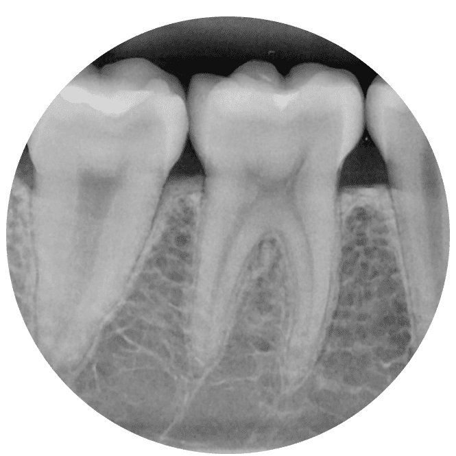 Irdo – Instituto de Radiodiagnóstico Odontológico
