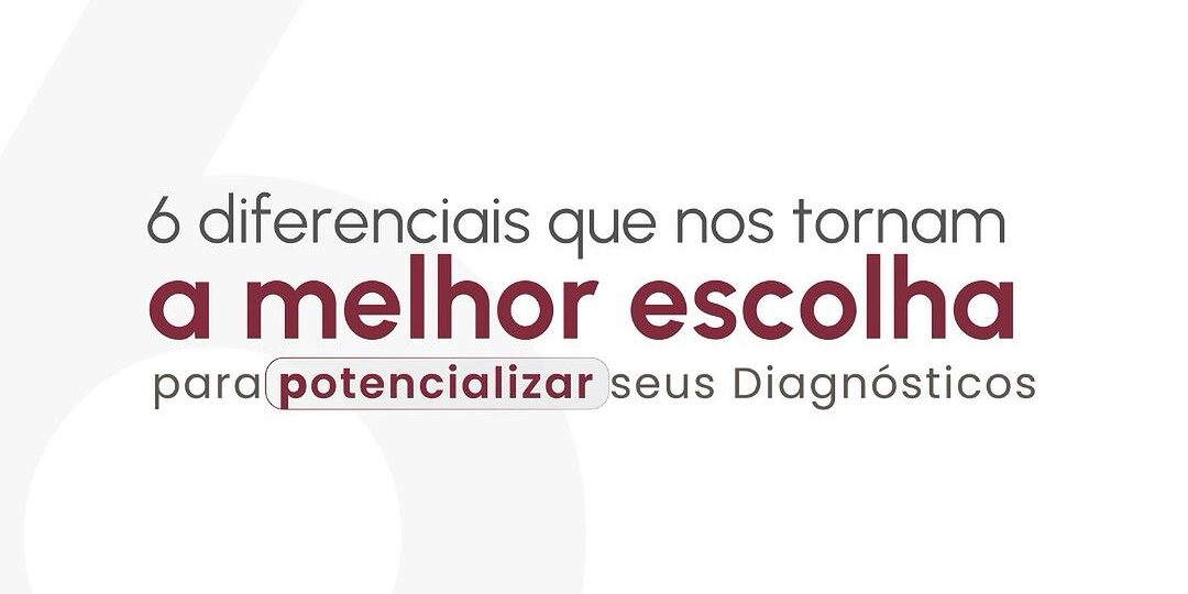 os-diferenciais