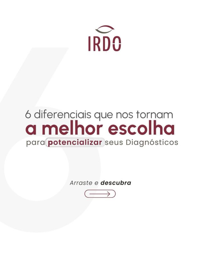 os-diferenciais