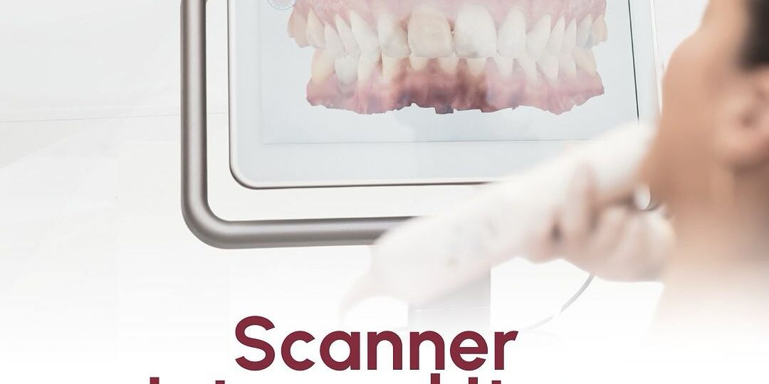 scanner-intraoral-itero