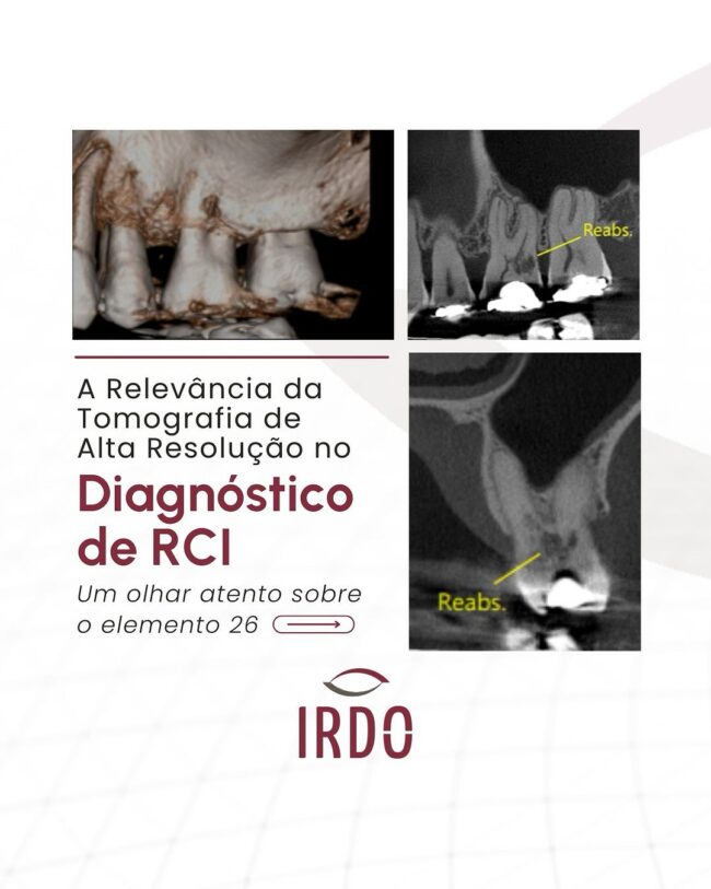 diagnostico-de-rci