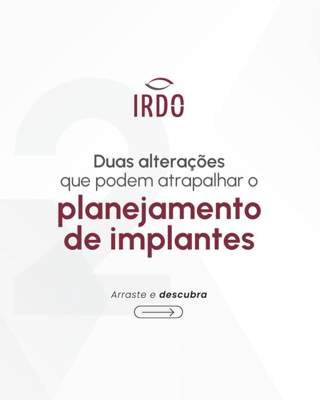 planejamento-de-implantes