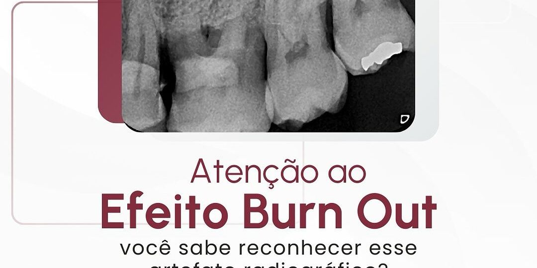 efeito-burn-out