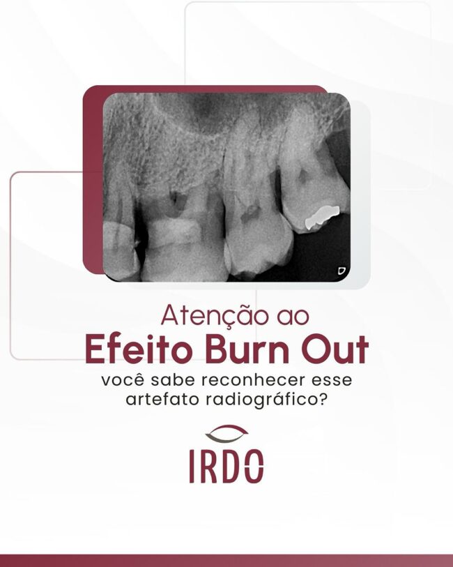 efeito-burn-out