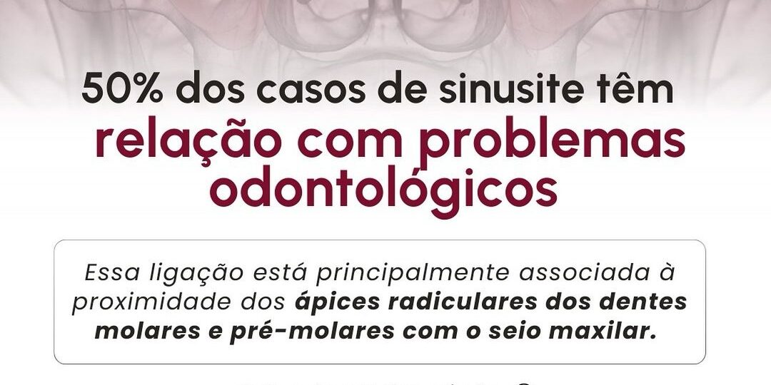 casos-de-sinusite