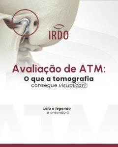 avaliacao-de-atm