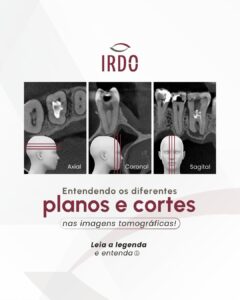 planos-e-cortes