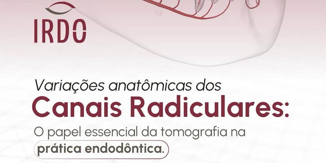 variacoes-anatomicas-dos-canais-radiculares