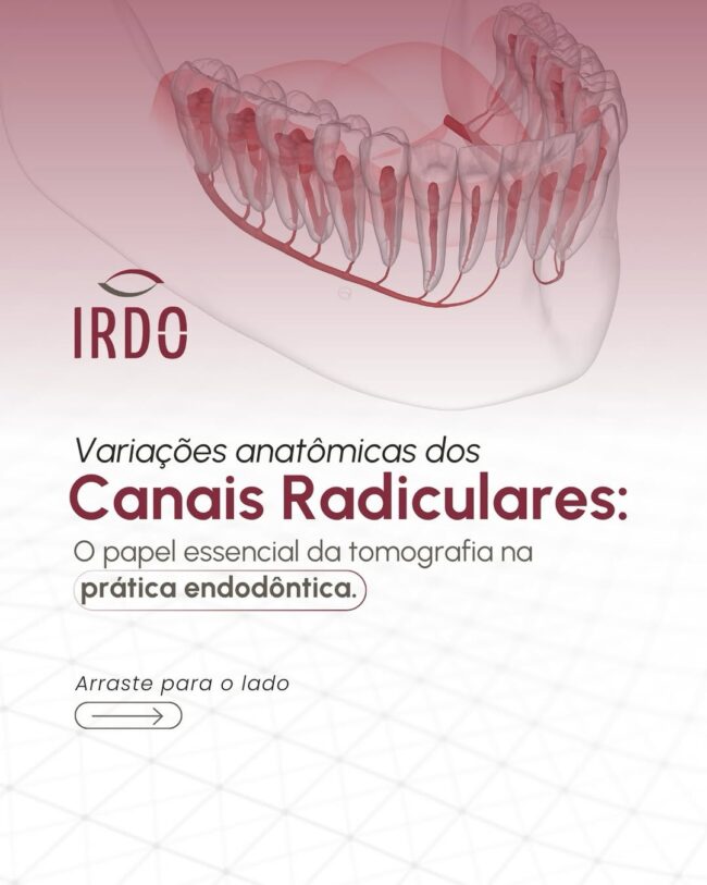 variacoes-anatomicas-dos-canais-radiculares