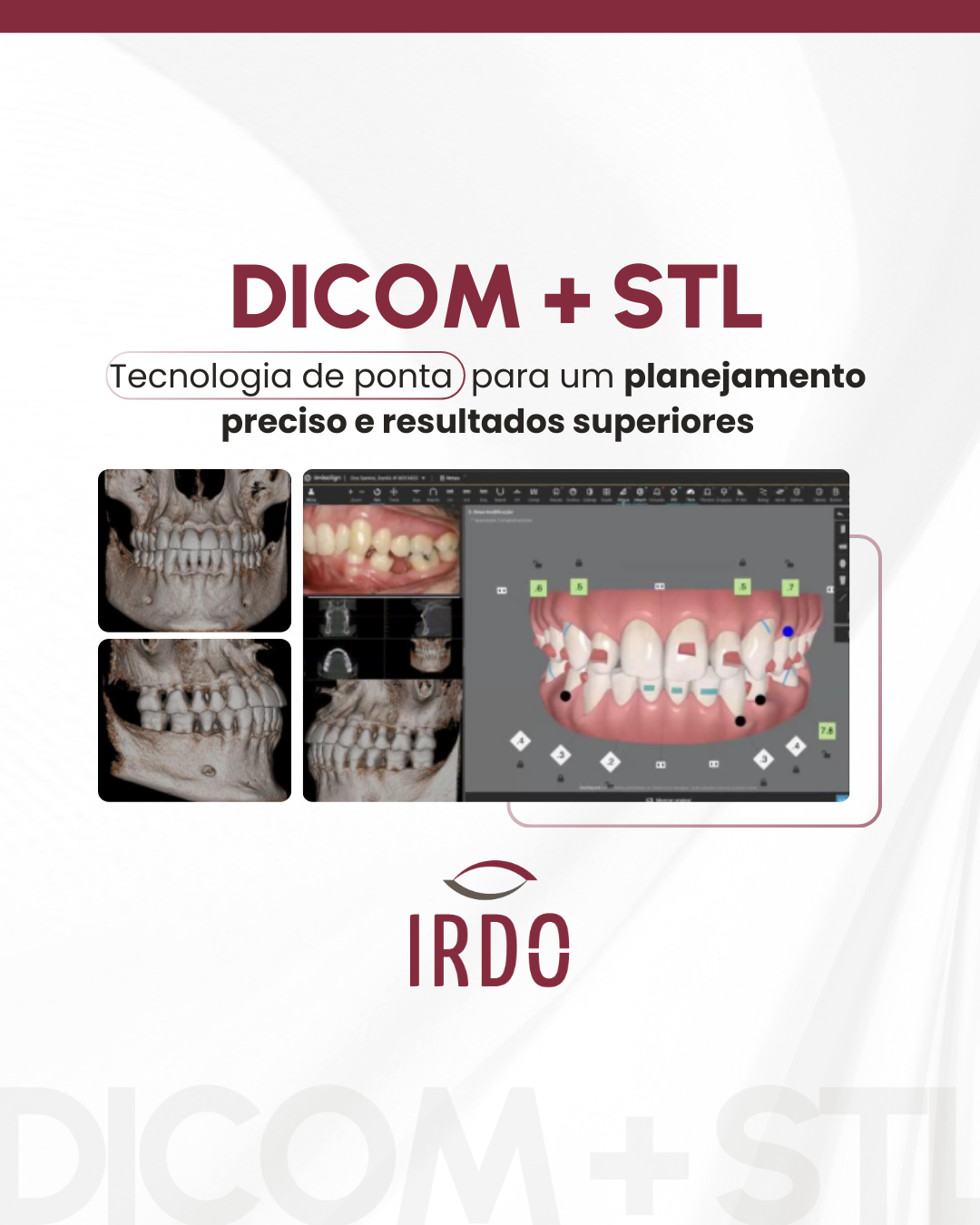 dicom-stl