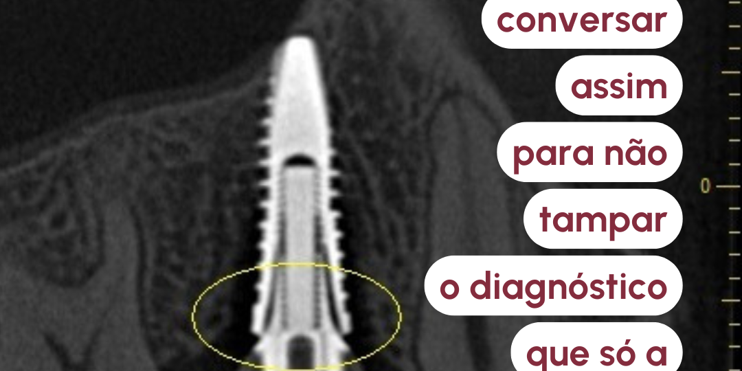 navegacao-no-viewer-tomografico