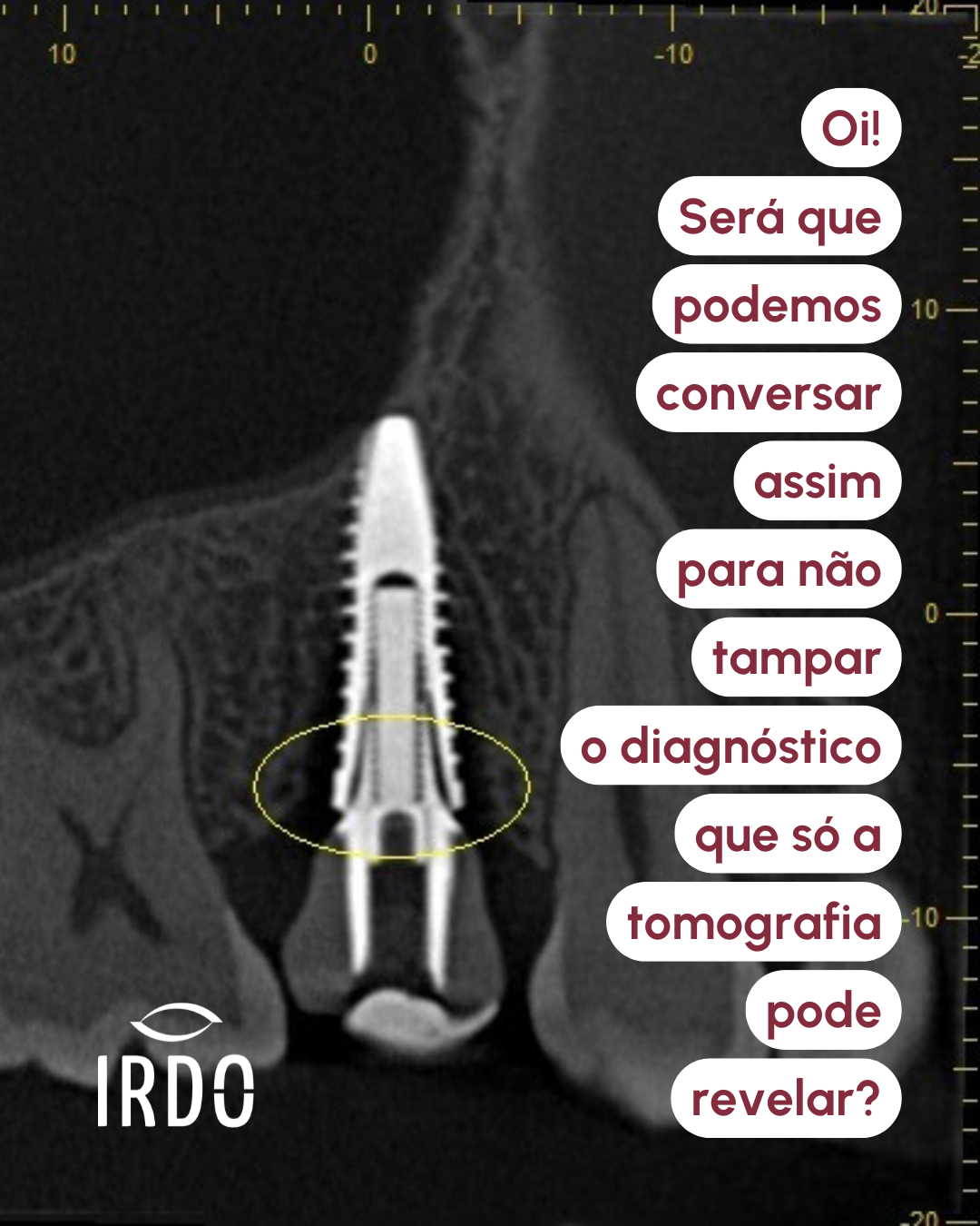 navegacao-no-viewer-tomografico