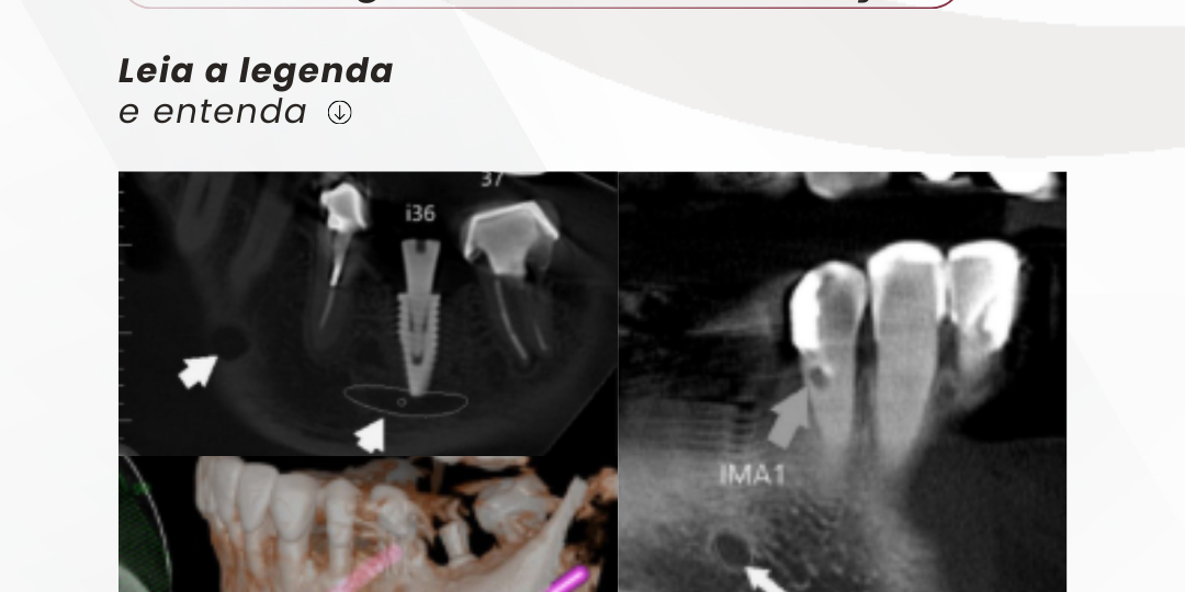 avaliacao-geral-de-mandibula