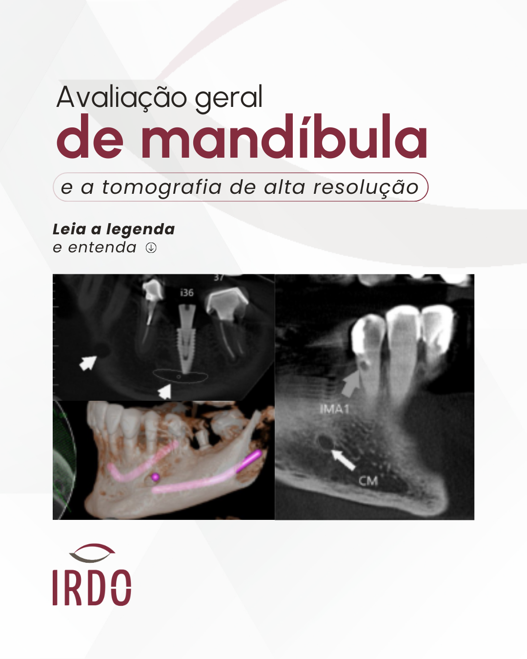 avaliacao-geral-de-mandibula