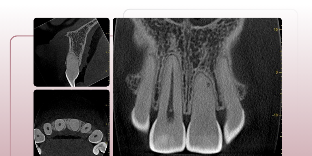tomografia-como-aliada-em-casos-pos-trauma