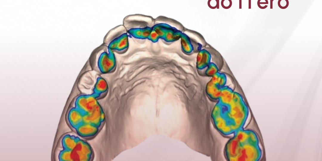 oclusograma-do-itero