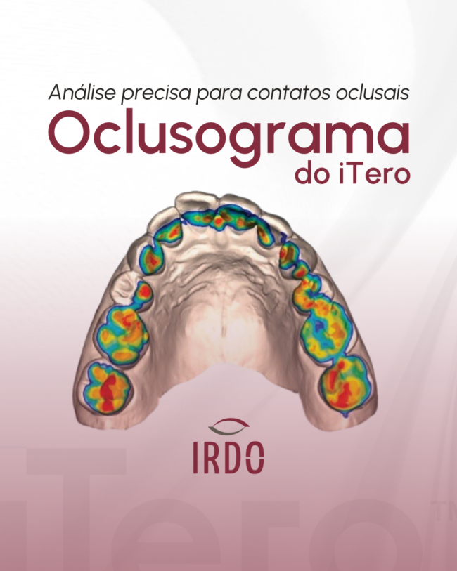 oclusograma-do-itero