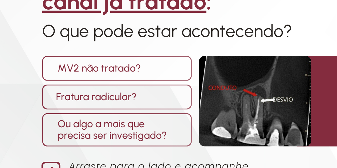 dor-em-um-molar-superior-ja-tratado