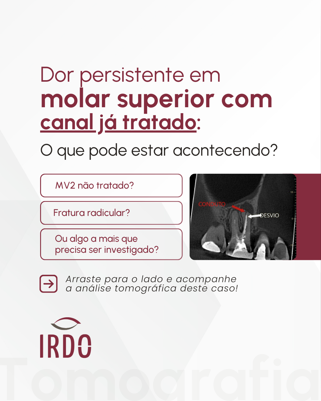 dor-em-um-molar-superior-ja-tratado