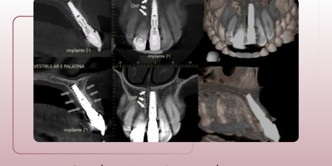 papel-do-acompanhamento-tomografico