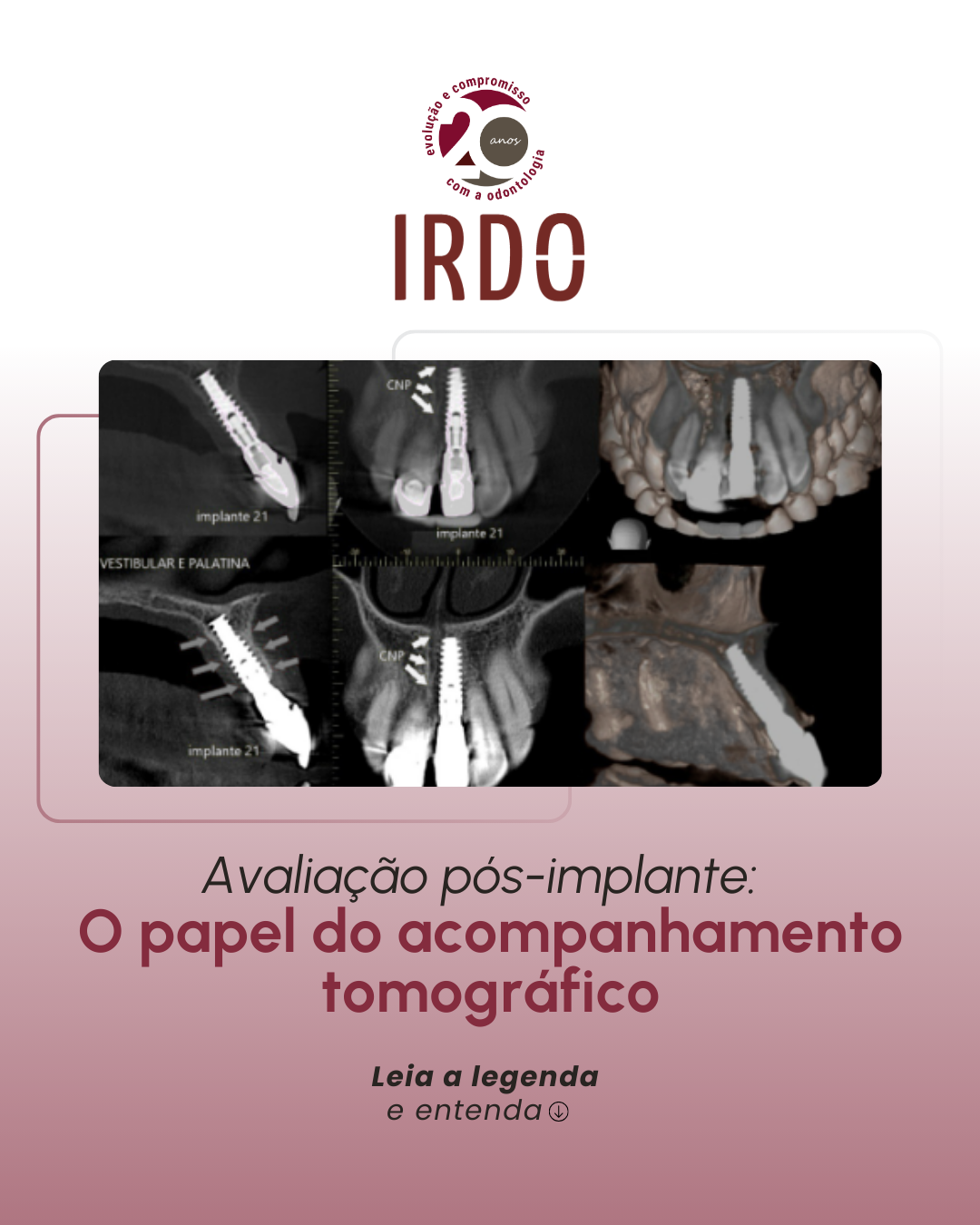 papel-do-acompanhamento-tomografico