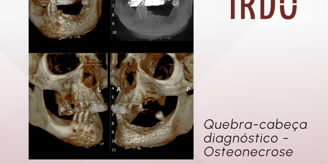 exame-de-imagem-sem-informacao-previa