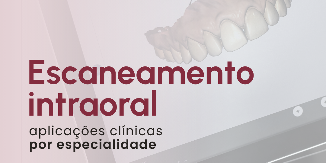 escaneamento-intraoral