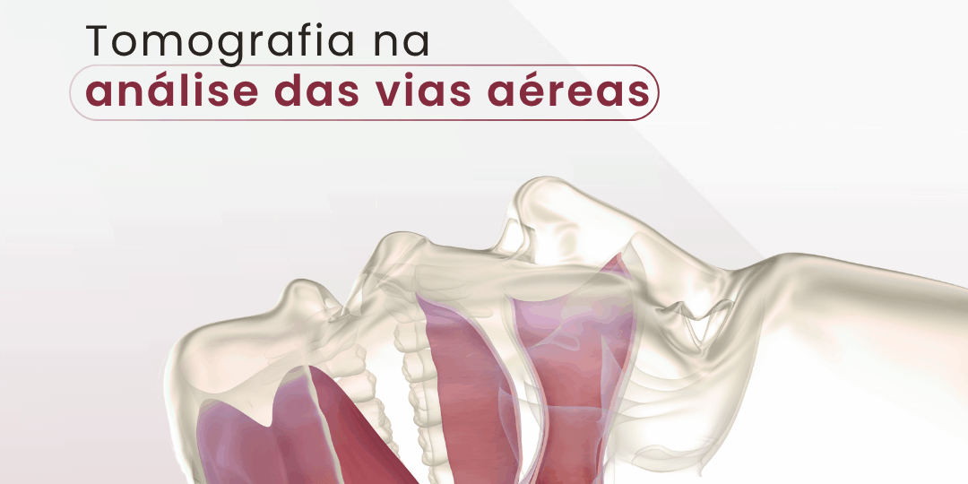 apneia-obstrutiva-do-sono