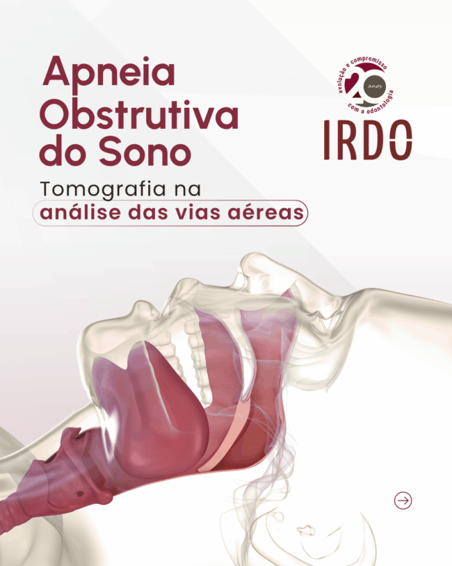 apneia-obstrutiva-do-sono