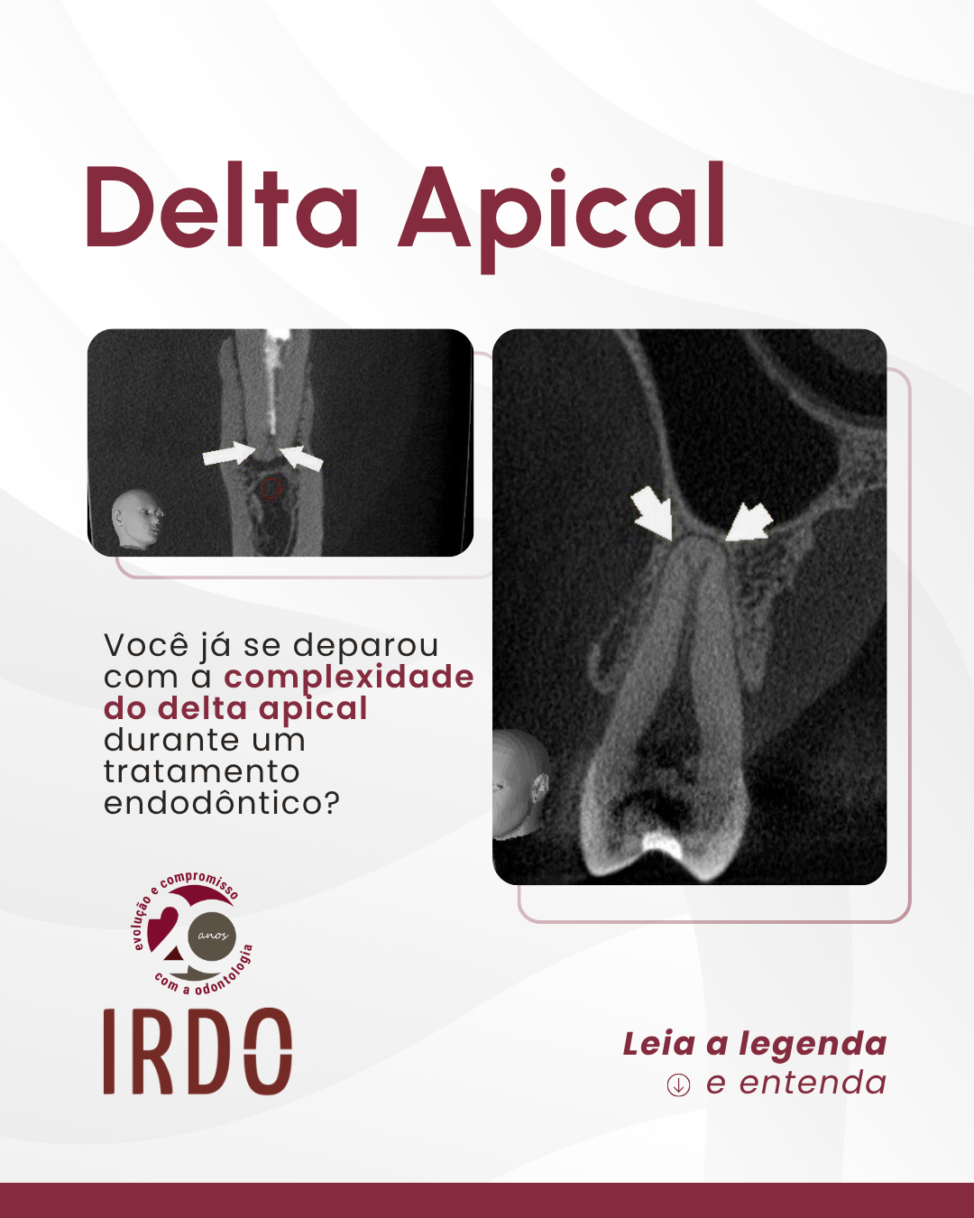 delta-apical