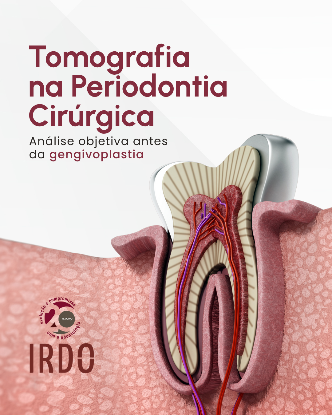 tomografia-na-periodontia-cirurgica