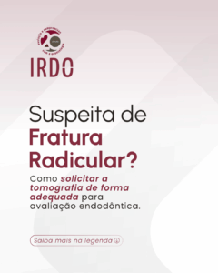 suspeita-de-fratura-radicular
