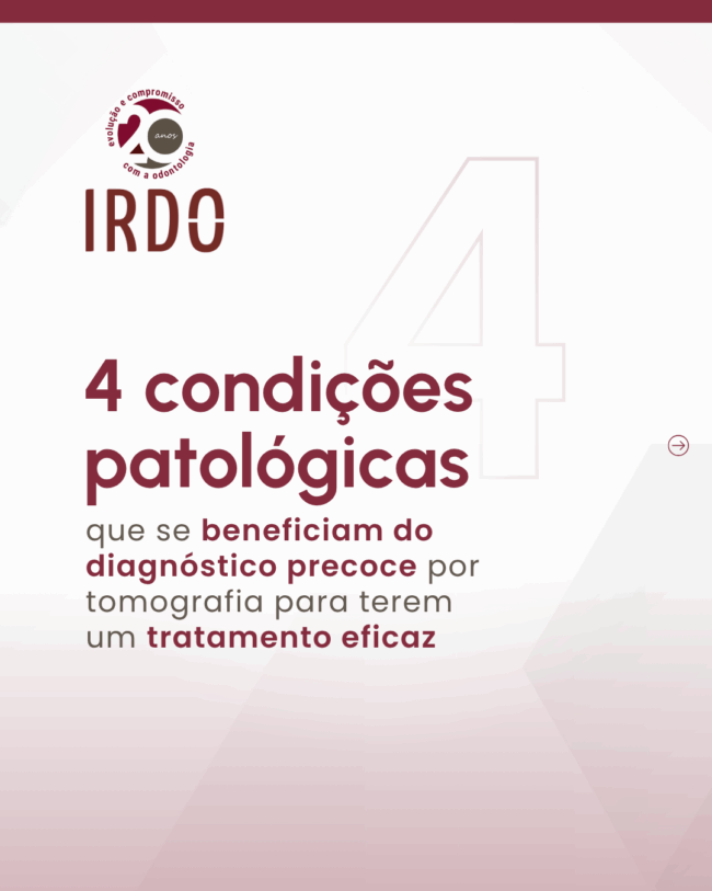 deteccao-precoce-da-alteracao-estrutural