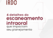 o-escaneamento-intraoral