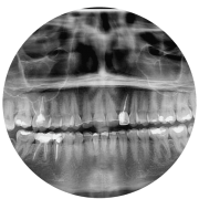 Raio-X Panorâmico - Irdo - Instituto de Radiodiagnóstico Odontológico - clinica radiológica - clinica de radiologia - radiologia odontológica - exames radiológicos